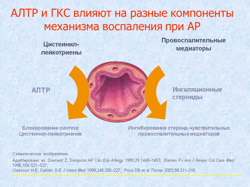 Ингибирование стероид-чувствительных  провоспалительных медиаторов АЛТР АЛТР и ГКС влияют на разные компоненты механизма